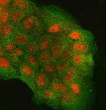 Immunofluorescent staining of FFPE human A431 cells with Regulator of G-protein signaling 9 antibody