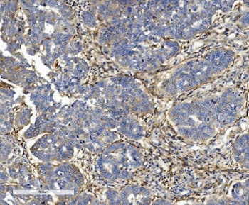 ITGB5 Antibody / Integrin beta 5