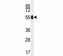 PAX1 Antibody