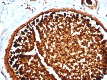IHC staining of FFPE human lactating breast tissue with recombinant SCGB2A2 antibody (clone MGB/4812