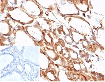 IHC staining of FFPE human thyroid tissue with Beta Actin (clone ACTB/1108). Negative control inset: