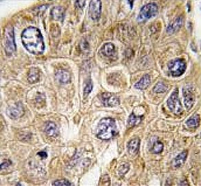 Squalene synthase Antibody / SQS / FDFT1