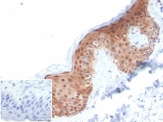IHC staining of FFPE human skin with SERPINB5 antibody (clone SERPINB5/4972). Negative control inset