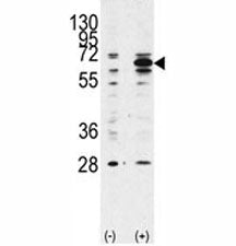 Beclin 1 Antibody