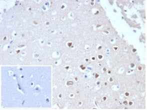 IHC staining of FFPE human cerebellum tissue with recombinant NeuN antibody (clone NeuN/288R). Negat