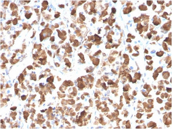 Growth Hormone Antibody / GH1