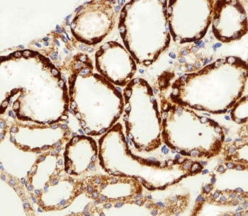 MPP7 Antibody