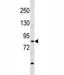 TBR1 Antibody