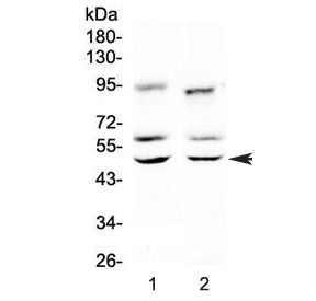 CAMK2A Antibody