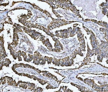 SDHB Antibody
