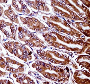 IHC testing of FFPE mouse stomach tissue with Map3k7 antibody. HIER: steam section in pH6 citrate bu