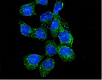 Immunofluorescent staining of FFPE human A431 cells with RASGAP antibody (green) and DAPI nuclear st