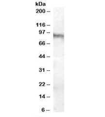 Western blot testing of human brain (amygdala) lysate with Neuroligin 3 antibody at 0.1ug/ml. Predic