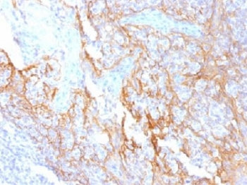 Beta Catenin Antibody