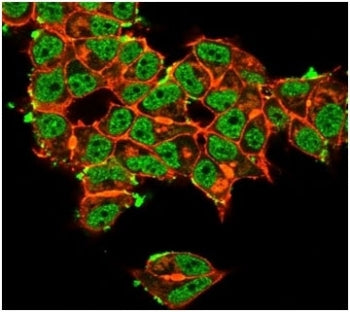 Immunofluorescent staining of PFA-fixed human MCF-7 cells Superoxide Dismutase 1 antibody (green, cl