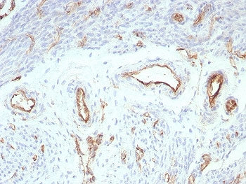 IHC staining of FFPE human uterus tissue with recombinant PECAM-1 antibody (clone rPECAM1/8827). HIE
