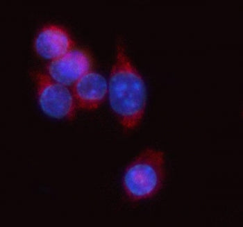 Immunofluorescent staining of FFPE mouse RAW264.7 cells with Antigen peptide transporter 1 antibody 