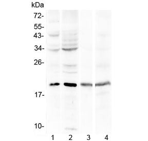 Western blot testing of human 1) HepG2, 2) HeLa, 3) HL-60 and 4) Jurkat cell lysate with Myoglobin a