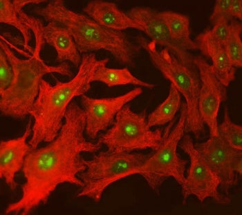 Immunofluorescent staining of FFPE human A549 cells with SPT5 antibody (green) and beta Tubulin mAb 