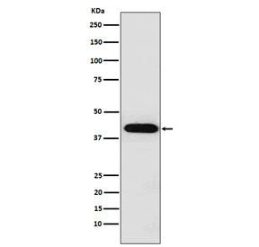Inhibin alpha Antibody / INHA