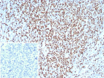 IHC staining of FFPE analysis of human tonsil tissue with Lymphoid enhancer-binding factor 1 antibod