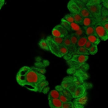 KRT19 Antibody / Cytokeratin 19