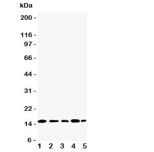 Western blot testing of TIA-1 antibody and Lane 1: Jurkat; 2: Raji; 3: CEM; 4: HT1080; 5: K562 cell 