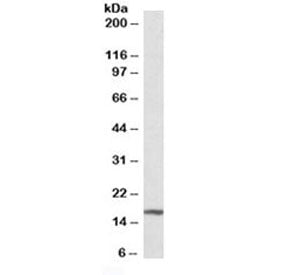 P16INK4a Antibody