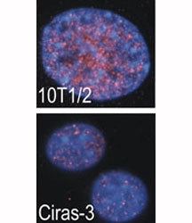 RSKB Antibody (MSK2)