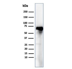Western blot testing of human liver tissue lysate using recombinant Albumin antibody (clone ALB/6409