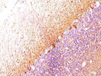 Neurofilament Antibody (-Light) / NF-L / NEFL