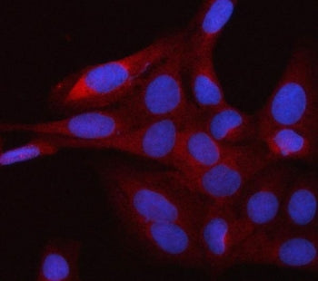 Immunofluorescent staining of FFPE human U-2 OS cells with smgGDS antibody (red) and DAPI nuclear st