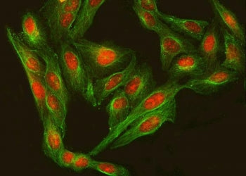 Immunofluorescent staining of FFPE human U-2 OS cells with Regulatory factor X 3 antibody (red) and 