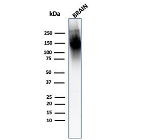 Western blot testing of human brain with Neurofilament antibody (clone 2F11).
