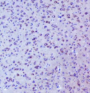 Igf2r Antibody / M6pr