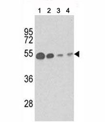 Tubulin beta 1 Antibody (TUBB1)