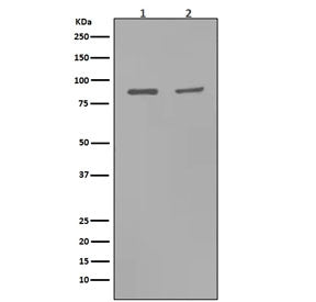 MMP9 Antibody / Matrix metalloproteinase-9