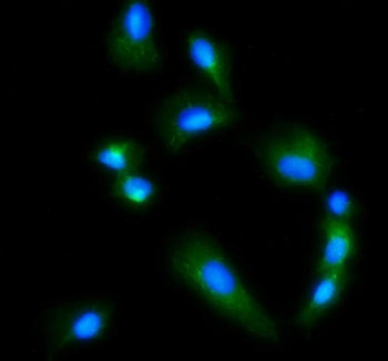 Glutaminase Antibody / GLS