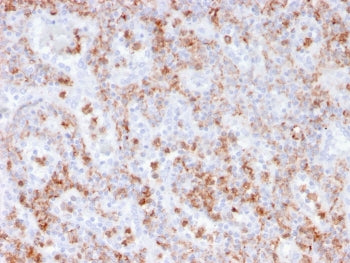 IHC staining of FFPE human spleen with recombinant S100A9 antibody (clone rMAC3781). HIER: boil tiss