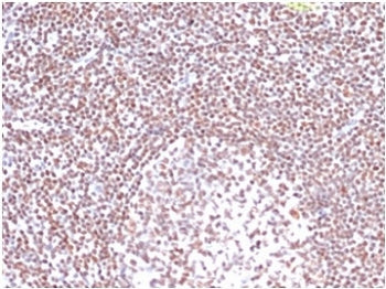 IHC staining of FFPE human tonsil tissue with RPA32 antibody (clone RPA2/4774). HIER: boil tissue se