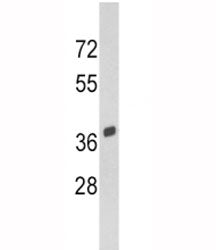 SPARC Antibody