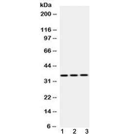 Western blot testing of 1) rat skeletal muscle, 2) mouse heart and 3) human HeLa lysate with Emerin 