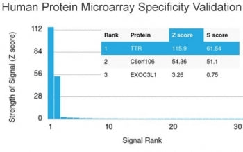 TTR Antibody / Transthyretin / Prealbumin