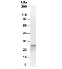 OTUB2 Antibody