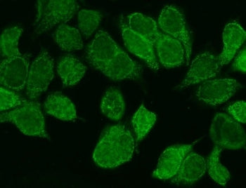 Immunofluorescent staining of FFPE human MCF7 cells with WNT8B antibody. HIER: steam section in pH6 