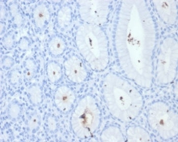 IHC staining of FFPE Helicobacter pylori-infected human stomach tissue with H pylori antibody (clone