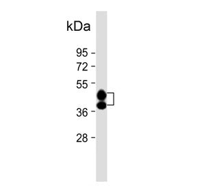 Haptoglobin Antibody