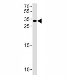 NKX6.3 Antibody