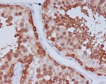 HSP90 beta Antibody / HSP90AB1