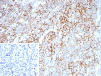 LAG3 Antibody / CD223